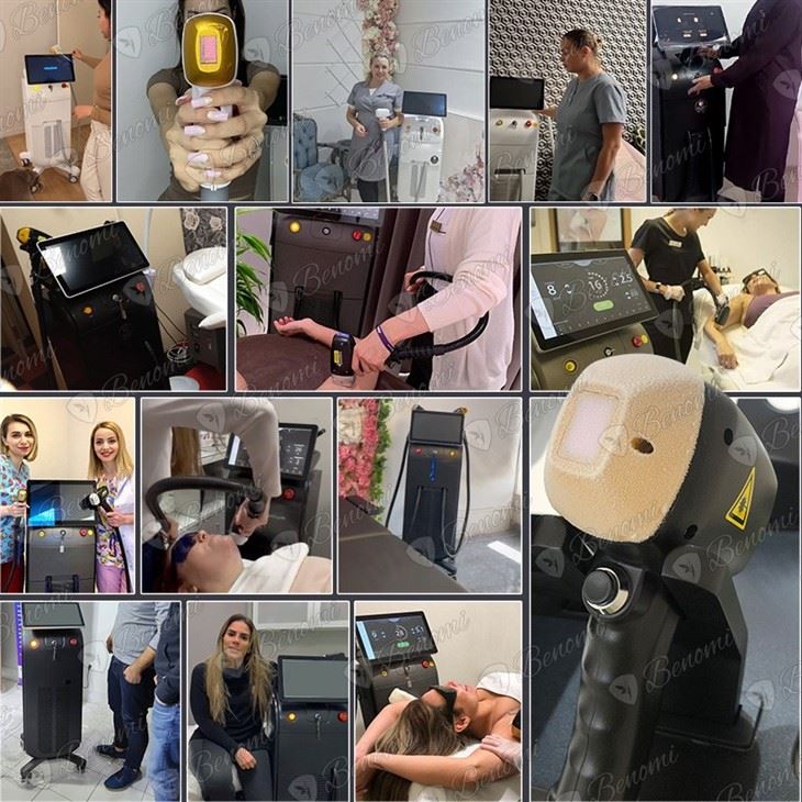 Diode Laser Hair Removal Machine Reviews