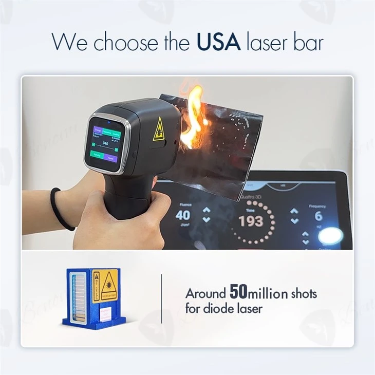 ND YAG+Diode Laser Hair Removal Machine Hot Sale