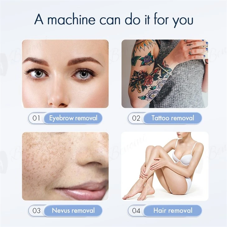 ND YAG+Diode Laser Hair Removal Machine Hot Sale