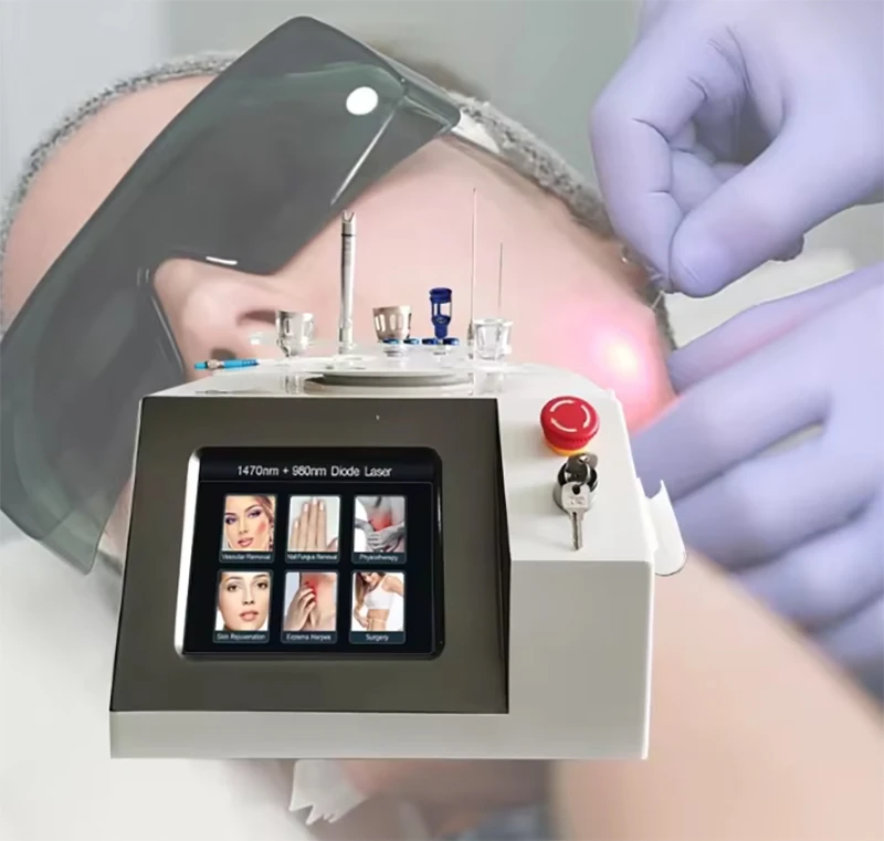 1470nm980nm-6--1-diode-laser-machine